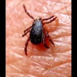 Congo Fever Outbreak in Oshikoto Region