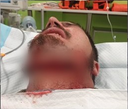 Vicious attack has Windhoek residents worried