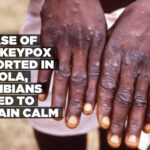A case of Monkeypox reported in Angola, Namibians urged to remain calm